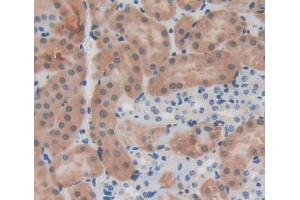 Used in DAB staining on fromalin fixed paraffin- embedded Kidney tissue (IL12RB1 抗体  (AA 197-348))