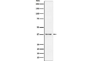 Western blot analysis of CD23 expression in Raji cell lysate.