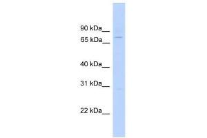 EFHC1 antibody used at 0.