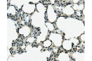 IHC analysis of REC8 using anti-REC8 antibody (ABIN7599473).