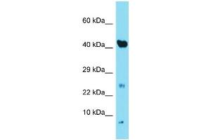 Western Blotting (WB) image for anti-NADH Dehydrogenase (Ubiquinone) 1 alpha Subcomplex, 3, 9kDa (NDUFA3) (C-Term) antibody (ABIN2789158)