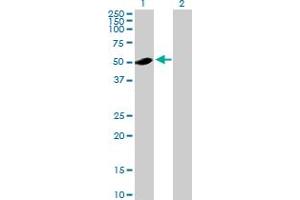 Western Blot analysis of ADSL expression in transfected 293T cell line by ADSL MaxPab polyclonal antibody. (Adenylosuccinate Lyase 抗体  (AA 1-484))
