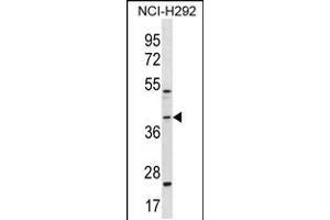 Western blot analysis in NCI-H292 cell line lysates (35ug/lane). (GIPC2 抗体  (C-Term))
