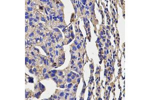 Immunohistochemistry (IHC) image for anti-Killer Cell Lectin-Like Receptor Subfamily D, Member 1 (KLRD1) (AA 32-179) antibody (ABIN3022763)