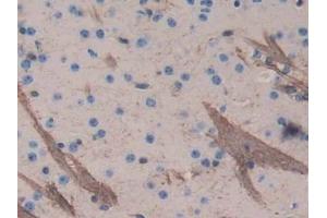 DAB staining on IHC-P; Samples: Mouse Cerebrum Tissue (Aggrecan 抗体  (AA 587-684))