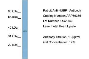 WB Suggested Anti-NUBP1  Antibody Titration: 0. (NUBP1 抗体  (Middle Region))