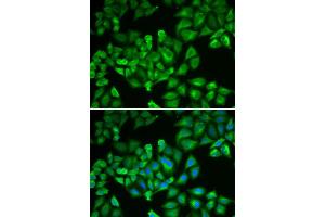 Immunofluorescence analysis of A549 cells using FTL antibody (ABIN5970889). (FTL 抗体)