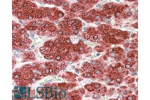 Immunohistochemistry (IHC) image for anti-Cytochrome P450, Family 17, Subfamily A, Polypeptide 1 (CYP17A1) (Internal Region) antibody (ABIN185617)