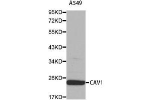 Western blot analysis of extracts of A549 cell using CAV1 antibody. (Caveolin-1 抗体  (AA 1-100))