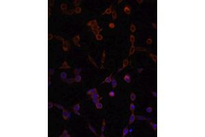 Immunofluorescence (IF) image for anti-Lysosomal-Associated Membrane Protein 1 (LAMP1) (AA 80-280) antibody (ABIN3016286)
