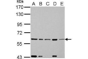 Western Blotting (WB) image for anti-Fas-Activated serine/threonine Kinase (FASTK) (C-Term) antibody (ABIN2855426)