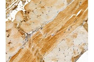 ABIN6261614 and ABIN6273044 at 1/100 staining Mouse skin tissue by IHC-P. (ETFB 抗体  (Internal Region))