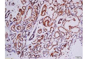 Formalin-fixed and paraffin embedded human kidney labeled with Rabbit Anti-RSK2(Tyr529) Polyclonal Antibody, Unconjugated (ABIN745283) at 1:200 followed by conjugation to the secondary antibody and DAB staining