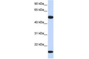 Image no. 1 for anti-Adenylosuccinate Synthase Like 1 (ADSSL1) (AA 144-193) antibody (ABIN6741031) (ADSSL1 抗体  (AA 144-193))