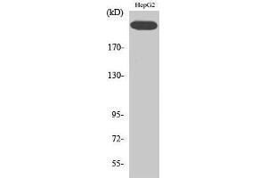 Western Blotting (WB) image for anti-VEGF Receptor 2 (VEGFR2) (pTyr1214) antibody (ABIN3179441) (VEGFR2/CD309 抗体  (pTyr1214))