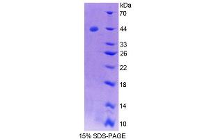 SDS-PAGE analysis of Human SYCN Protein. (SYCN 蛋白)
