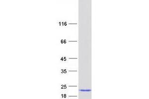 Western Blotting (WB) image for Peptidylprolyl Isomerase (Cyclophilin)-Like 1 (PPIL1) protein (Myc-DYKDDDDK Tag) (ABIN2729445)