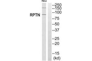Western blot analysis of extracts from HeLa cells, using RPTN antibody. (Repetin 抗体  (C-Term))