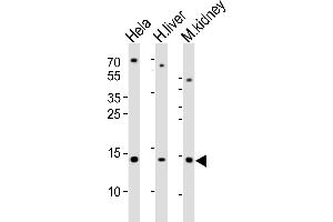 Western blot analysis of lysates from Hela cell line, human liver and mouse kidney tissue lysate(from left to right), using CDA Antibody (Center) (ABIN389394 and ABIN2839486). (CDA 抗体  (AA 51-83))