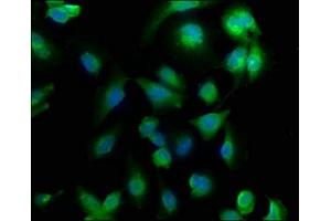 Immunofluorescence staining of U251 cells with ABIN7166977 at 1:133, counter-stained with DAPI. (CHML 抗体  (AA 480-656))