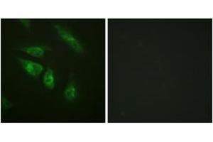 Immunofluorescence analysis of HeLa cells, using NFAT3 (Ab-676) Antibody.