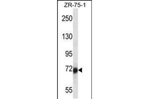 Western blot analysis in ZR-75-1 cell line lysates (35ug/lane). (SP100 抗体  (N-Term))