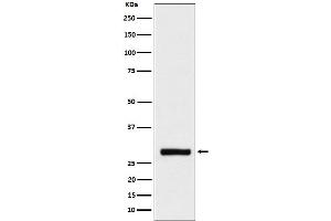 Western blot analysis of BRMS1 expression in HeLa cell lysate. (Recombinant BRMS1 抗体)
