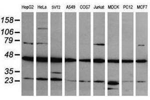 Image no. 1 for anti-Mitogen-Activated Protein Kinase Kinase 1 (MAP2K1) antibody (ABIN1499378) (MEK1 抗体)