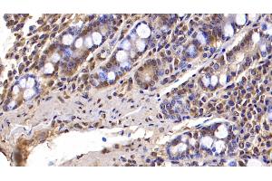 Detection of FBLN3 in Human Small intestine Tissue using Monoclonal Antibody to Fibulin 3 (FBLN3) (FBLN3 抗体  (AA 26-213))