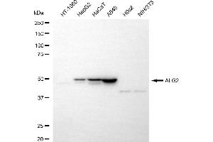 Western blotting analysis using ALG2 antibody (ABIN7797663). (ALG2 抗体)
