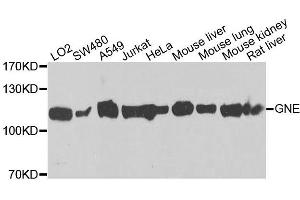 Western blot analysis of extracts of various cell lines, using GNE antibody (ABIN5996449) at 1/1000 dilution. (GNE 抗体)
