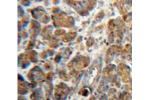 Used in DAB staining on fromalin fixed paraffin-embedded Pancreas tissue (NPTX2 抗体  (AA 111-367))