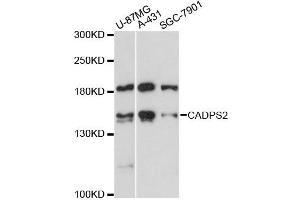 Western blot analysis of extracts of various cell lines, using CADPS2 antibody (ABIN6292762) at 1:3000 dilution. (CADPS2 抗体)