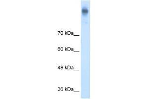 Western Blot showing SLC12A2 antibody used at a concentration of 1-2 ug/ml to detect its target protein.