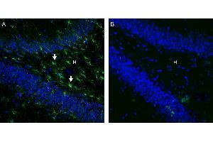 Expression of GPR43/FFAR2 in rat hippocampus. (FFAR2 抗体  (Intracellular))
