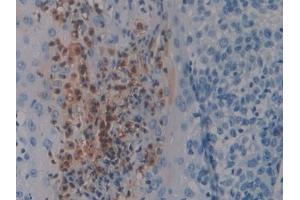 Immunohistochemistry (IHC) image for anti-S100 Calcium Binding Protein P (S100P) (AA 1-95) antibody (ABIN7434620)