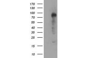 HEK293T cells were transfected with the pCMV6-ENTRY control (Left lane) or pCMV6-ENTRY TACC3 (Right lane) cDNA for 48 hrs and lysed. (TACC3 抗体)