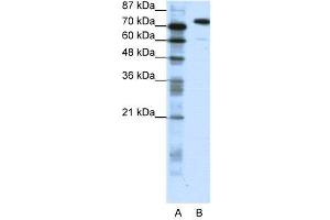 WB Suggested Anti-SATB1  Antibody Titration: 1. (SATB1 抗体  (C-Term))