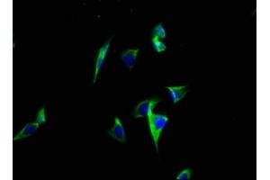 Immunofluorescence staining of A549 cells with ABIN7146408 at 1:100, counter-stained with DAPI. (ATP2C2 抗体  (AA 621-702))