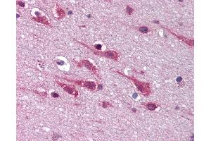 Anti-MAPK9 / JNK2 antibody IHC of human brain, cortex.