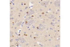 Immunohistochemistry analysis of paraffin-embedded rat brain using VMAT2 (ABIN7075655) at dilution of 1: 1600 (SLC18A2 抗体)