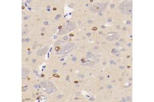 Immunohistochemistry analysis of paraffin-embedded rat brain using VMAT2 (ABIN7075655) at dilution of 1: 1600 (SLC18A2 抗体)