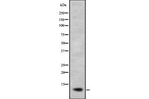 Western blot analysis of NDUFB2 expression in A673 lysate;,The lane on the left is treated with the antigen-specific peptide. (NDUFB2 抗体  (Internal Region))