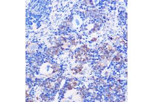 Immunohistochemistry of paraffin-embedded mouse spleen using CD24 Rabbit pAb (ABIN1512696, ABIN3023213, ABIN3023214 and ABIN6219443) at dilution of 1:100 (40x lens). (CD24 抗体  (AA 1-80))