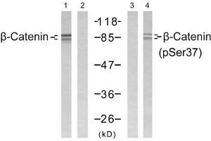 Western blot analysis of extract from SW 626 cells, using β-Catenin (Ab-37) antibody (E021212, Lane 1 and 2) and β-Catenin (phospho-Ser37) antibody (E011219, Lane 3 and 4). (beta Catenin 抗体  (pSer37))