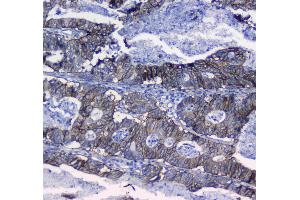 IHC analysis of Integrin alpha 5 using anti-Integrin alpha 5 antibody . (ITGA5 抗体  (AA 42-263))