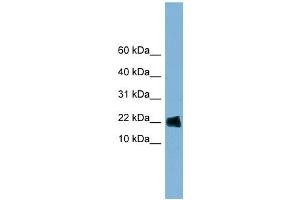 WB Suggested Anti-GOLGA7 Antibody Titration: 0. (Golgin A7 抗体  (Middle Region))