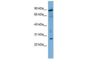 UBE2F antibody used at 0. (UBE2F 抗体  (Middle Region))