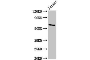 Western Blot Positive WB detected in: Jurkat whole cell lysate All lanes: IGF2BP1 antibody at 5. (IGF2BP1 抗体  (AA 440-534))