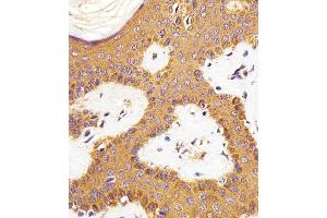 Immunohistochemical analysis of paraffin-embedded H. (RAC1 抗体)